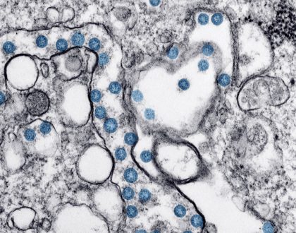 El coronavirus COVID-19 es una pandemia